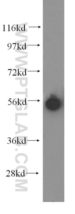 KRT81 Rabbit anti-Human, Mouse, Rat, Polyclonal, Proteintech 150 &mu;L;