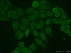 HDGF Rabbit anti-Human, Polyclonal, Proteintech 150 &mu;L; Unconjugated:Antibodies,