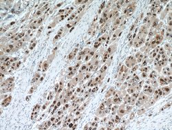 HDGF Rabbit anti-Human, Polyclonal, Proteintech 150 &mu;L; Unconjugated:Antibodies,