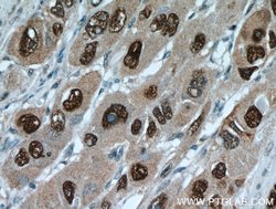 HDGF Rabbit anti-Human, Polyclonal, Proteintech 150 &mu;L; Unconjugated:Antibodies,