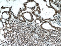 HDGF Rabbit anti-Human, Polyclonal, Proteintech 150 &mu;L; Unconjugated:Antibodies,