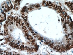 HDGF Rabbit anti-Human, Polyclonal, Proteintech 150 &mu;L; Unconjugated:Antibodies,