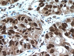 HDGF Rabbit anti-Human, Polyclonal, Proteintech 150 &mu;L; Unconjugated:Antibodies,