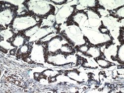 HDGF Rabbit anti-Human, Polyclonal, Proteintech 150 &mu;L; Unconjugated:Antibodies,