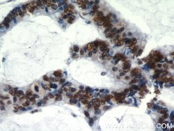 HDGF Rabbit anti-Human, Polyclonal, Proteintech 150 &mu;L; Unconjugated:Antibodies,