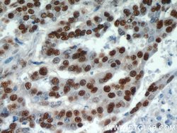 HDGF Rabbit anti-Human, Polyclonal, Proteintech 150 &mu;L; Unconjugated:Antibodies,