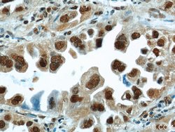 HDGF Rabbit anti-Human, Polyclonal, Proteintech