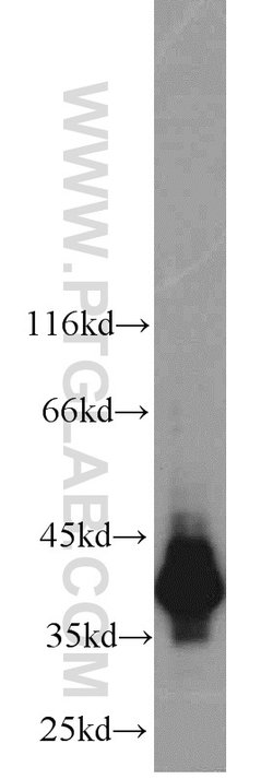 HDGF Rabbit anti-Human, Polyclonal, Proteintech 150 &mu;L; Unconjugated:Antibodies,