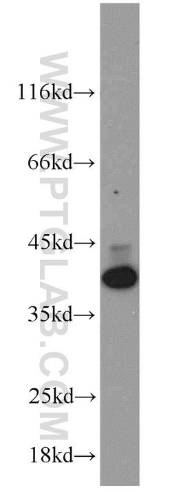 HDGF Rabbit anti-Human, Polyclonal, Proteintech 150 &mu;L; Unconjugated:Antibodies,