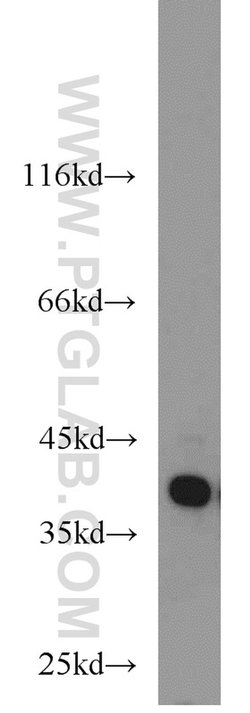 HDGF Rabbit anti-Human, Polyclonal, Proteintech 150 &mu;L; Unconjugated:Antibodies,