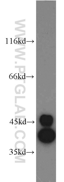 HDGF Rabbit anti-Human, Polyclonal, Proteintech 150 &mu;L; Unconjugated:Antibodies,