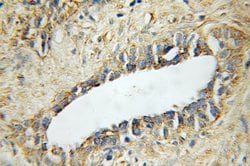 STAMBP Rabbit anti-Human, Mouse, Rat, Polyclonal, Proteintech 150 &mu;L;