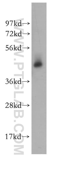 STAMBP Rabbit anti-Human, Mouse, Rat, Polyclonal, Proteintech 150 &mu;L;