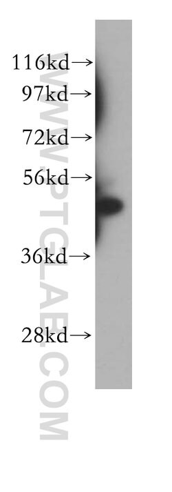 STAMBP Rabbit anti-Human, Mouse, Rat, Polyclonal, Proteintech 150 &mu;L;