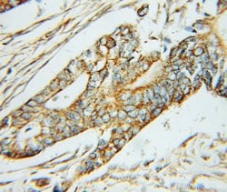 ABAT Rabbit anti-Human, Mouse, Rat, Polyclonal, Proteintech 150 &mu;L;