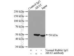ABAT Rabbit anti-Human, Mouse, Rat, Polyclonal, Proteintech 150 &mu;L;