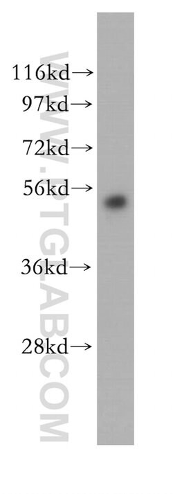 ABAT Rabbit anti-Human, Mouse, Rat, Polyclonal, Proteintech 150 &mu;L;