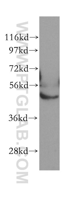 ABAT Rabbit anti-Human, Mouse, Rat, Polyclonal, Proteintech 150 &mu;L;