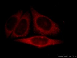 MYDGF Rabbit anti-Human, Mouse, Polyclonal, Proteintech:Antibodies:Primary