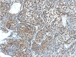 MYDGF Rabbit anti-Human, Mouse, Polyclonal, Proteintech:Antibodies:Primary
