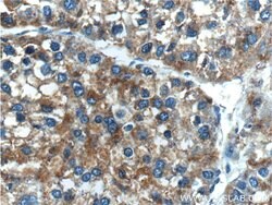 MYDGF Rabbit anti-Human, Mouse, Polyclonal, Proteintech:Antibodies:Primary
