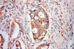 MYDGF Rabbit anti-Human, Mouse, Polyclonal, Proteintech:Antibodies:Primary