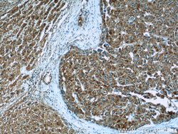 MYDGF Rabbit anti-Human, Mouse, Polyclonal, Proteintech:Antibodies:Primary