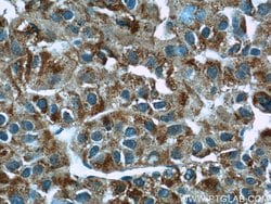 MYDGF Rabbit anti-Human, Mouse, Polyclonal, Proteintech:Antibodies:Primary