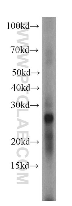 MYDGF Rabbit anti-Human, Mouse, Polyclonal, Proteintech:Antibodies:Primary