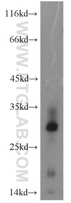 MYDGF Rabbit anti-Human, Mouse, Polyclonal, Proteintech:Antibodies:Primary