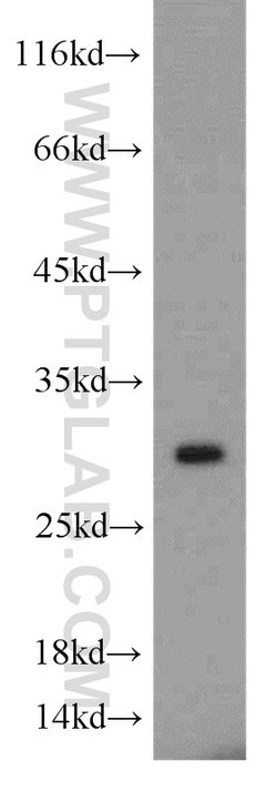 MYDGF Rabbit anti-Human, Mouse, Polyclonal, Proteintech:Antibodies:Primary