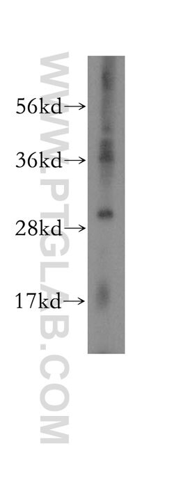 MYDGF Rabbit anti-Human, Mouse, Polyclonal, Proteintech:Antibodies:Primary
