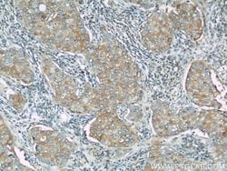 LGP2 Rabbit anti-Human, Mouse, Rat, Polyclonal, Proteintech:Antibodies:Primary