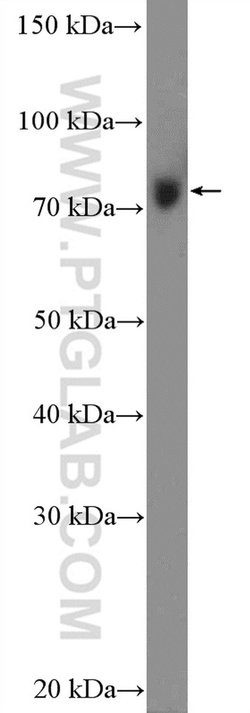 LGP2 Rabbit anti-Human, Mouse, Rat, Polyclonal, Proteintech:Antibodies:Primary