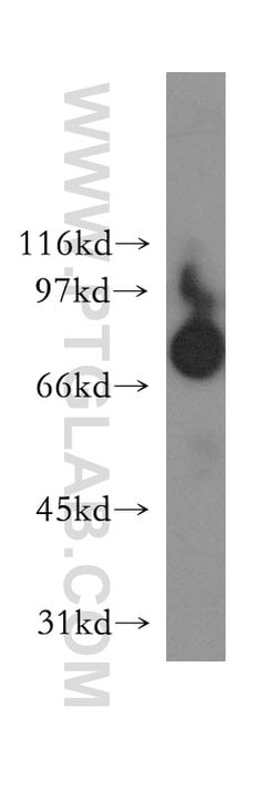 Harmonin Rabbit anti-Human, Mouse, Rat, Polyclonal, Proteintech:Antibodies:Primary