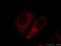 Harmonin Rabbit anti-Human, Mouse, Rat, Polyclonal, Proteintech:Antibodies:Primary