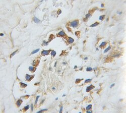Harmonin Rabbit anti-Human, Mouse, Rat, Polyclonal, Proteintech:Antibodies:Primary