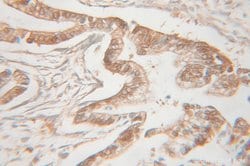 UMP/CMP kinase Rabbit anti-Human, Mouse, Rat, Polyclonal, Proteintech 150