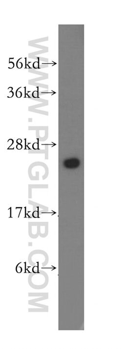 UMP/CMP kinase Rabbit anti-Human, Mouse, Rat, Polyclonal, Proteintech 150
