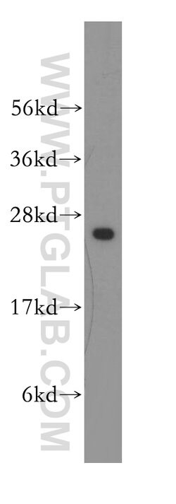 UMP/CMP kinase Rabbit anti-Human, Mouse, Rat, Polyclonal, Proteintech 150