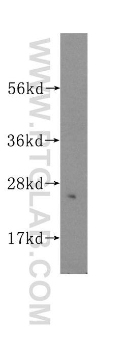 UMP/CMP kinase Rabbit anti-Human, Mouse, Rat, Polyclonal, Proteintech 150