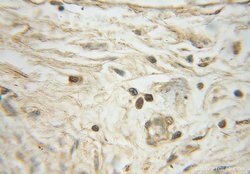 MCRS1 Rabbit anti-Human, Mouse, Rat, Polyclonal, Proteintech 20 &mu;L;