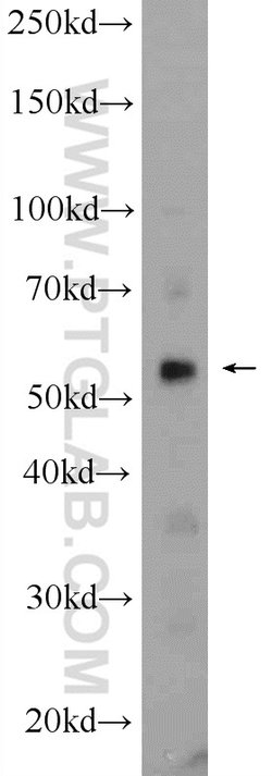 MCRS1 Rabbit anti-Human, Mouse, Rat, Polyclonal, Proteintech 20 &mu;L;
