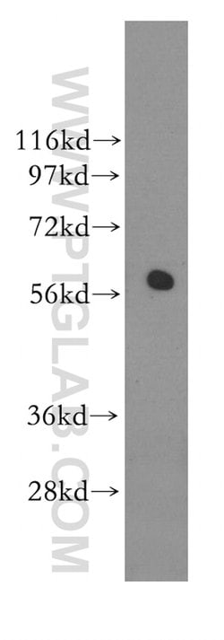 RAD23A Rabbit anti-Human, Mouse, Rat, Polyclonal, Proteintech