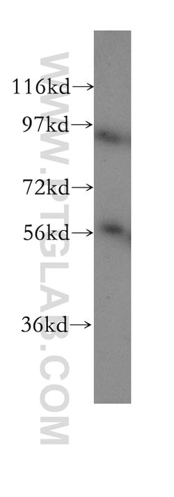 RAD23A Rabbit anti-Human, Mouse, Rat, Polyclonal, Proteintech:Antibodies:Primary