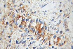 UBE2D1 Rabbit anti-Human, Mouse, Rat, Polyclonal, Proteintech 150 &mu;L;