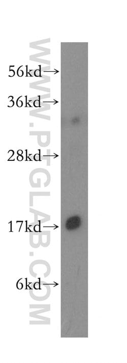 UBE2D1 Rabbit anti-Human, Mouse, Rat, Polyclonal, Proteintech 150 &mu;L;