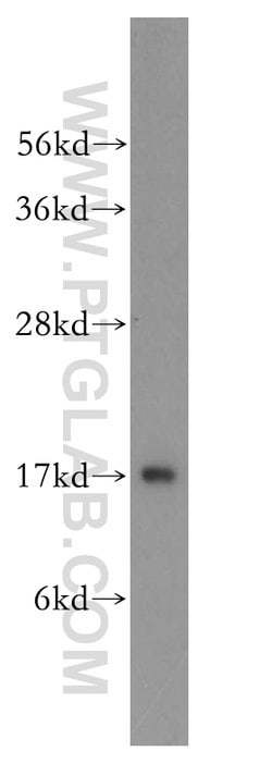 UBE2D1 Rabbit anti-Human, Mouse, Rat, Polyclonal, Proteintech 150 &mu;L;