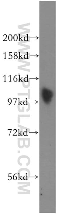 SP100 Rabbit anti-Human, Polyclonal, Proteintech 150 &mu;L; Unconjugated:Antibodies,