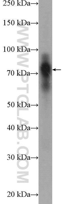 Cortactin Rabbit anti-Human, Mouse, Rat, Polyclonal, Proteintech:Antibodies:Primary